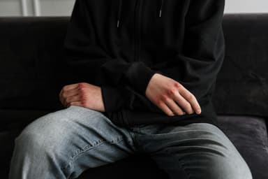 Anxietatea la copii – manifestări fizice
